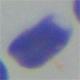 Descripcin: Macintosh HD:Users:antoni:UIB:Bases de Dades Recerca:Version 2:erythrocytesIDB1:individual cells:other:o0001.jpg