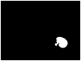 Descripcin: Macintosh HD:Users:antoni:UIB:Bases de Dades Recerca:Version 2:erythrocytesIDB3:17erythrocytesIDB3:mask-other.jpg